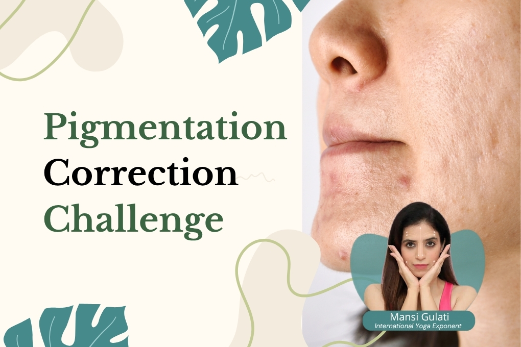 pigmentation pigmentation