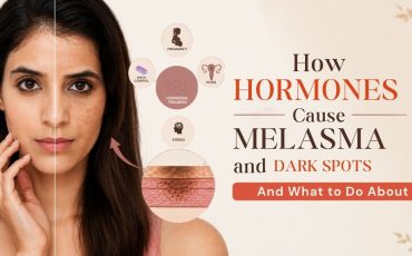 How Hormones Cause